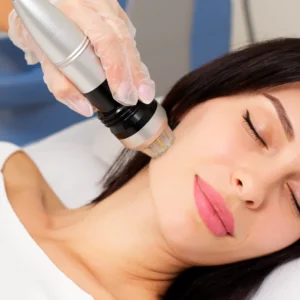 Advanced RF Microneedling for Face and Neck